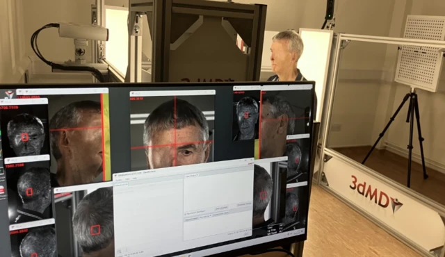 У Британії для постраждалого в аварії велосипедиста надрукували на 3D-принтері частину обличчя